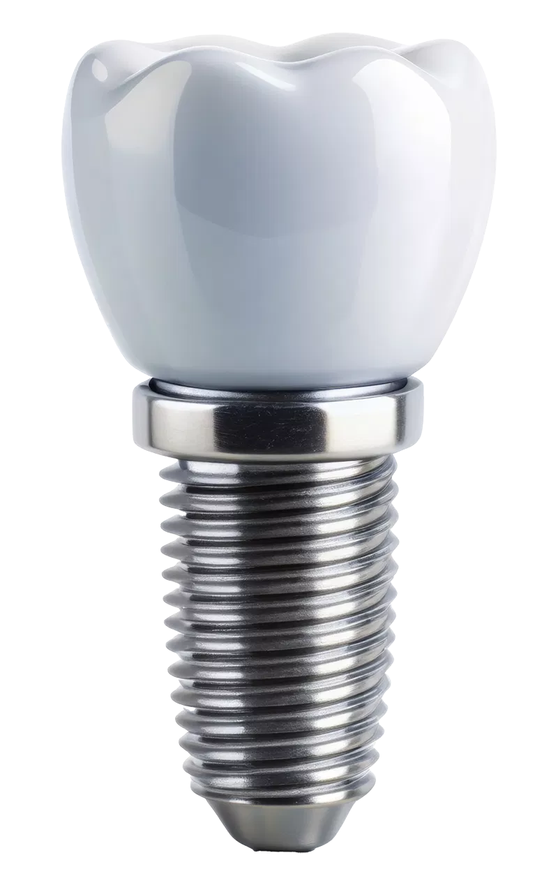 Dental implant treatment at Pearl32 Dentistry in Laguna Hills, CA