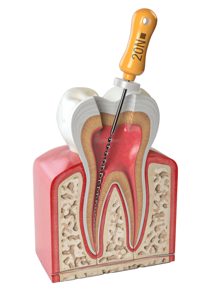 Dental care at Pearl32 Dentistry and Wellness in Laguna Hills, CA
