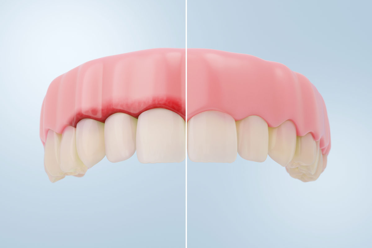 Dental care at Pearl32 Dentistry and Wellness in Laguna Hills, CA