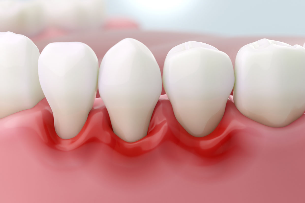 Dental care at Pearl32 Dentistry and Wellness in Laguna Hills, CA